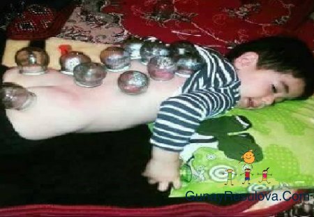 "XALQ TƏBABƏTİ" kimi bildiyiniz YALNIŞLAR