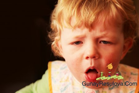 Göy öskürək və ya Göy öskürəyə bənzər sindromlar
